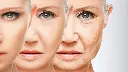 17301680771000548432.webp