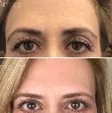 17301680761000548396.webp